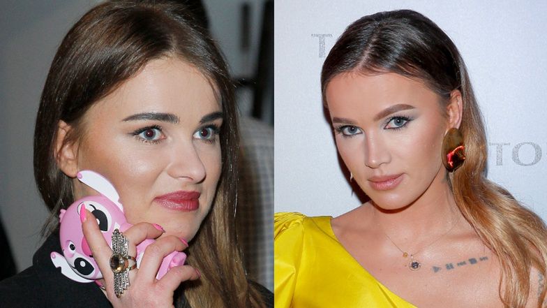 Gwiazdy, które zrobiły sobie nos