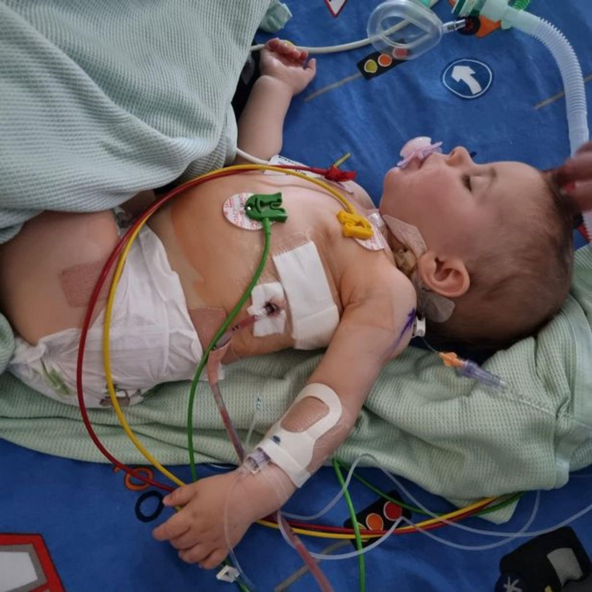 Chłopiec krztusił się i wymiotował podczas każdego posiłku