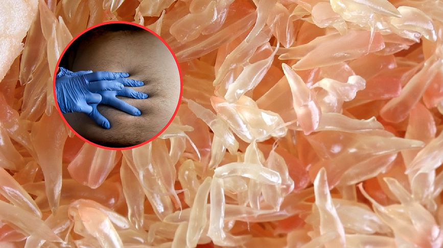 Najzdrowsze owoce. Skutecznie wspierają wątrobę