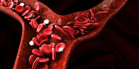 Anemia sierpowata - wpływ na organizm, objawy