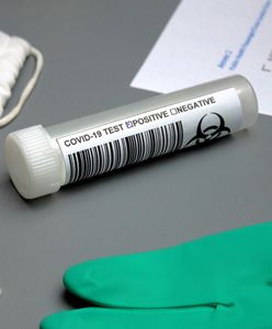 Japonia apeluje do Chin. Powodem analne testy na koronawirusa