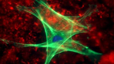 Ipilimumab - bat na czerniaka? 1