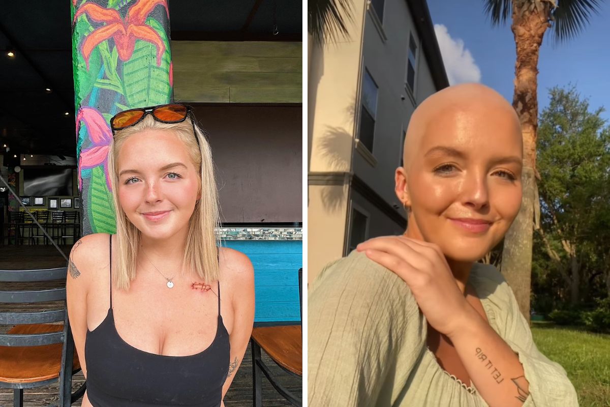 Madison w wieku 25 lat dowiedziała się, że choruje na nowotwór