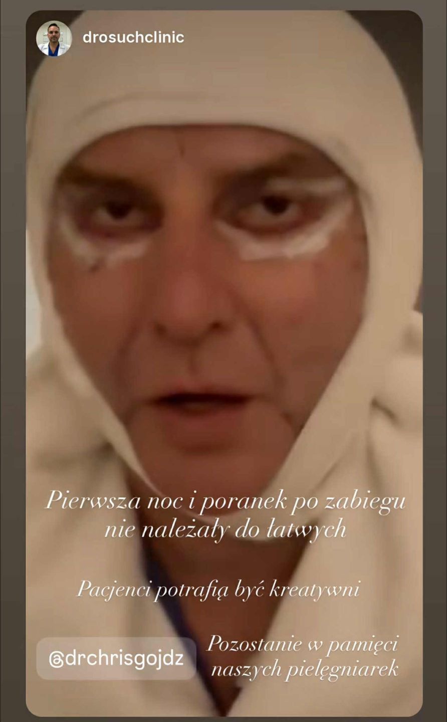 Krzysztof Gojdź śmieszkuje pierwszej nocy po liftingu