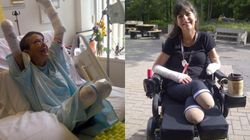 Po ugryzieniu psa amputowano jej nogi i rękę. Miała sepsę