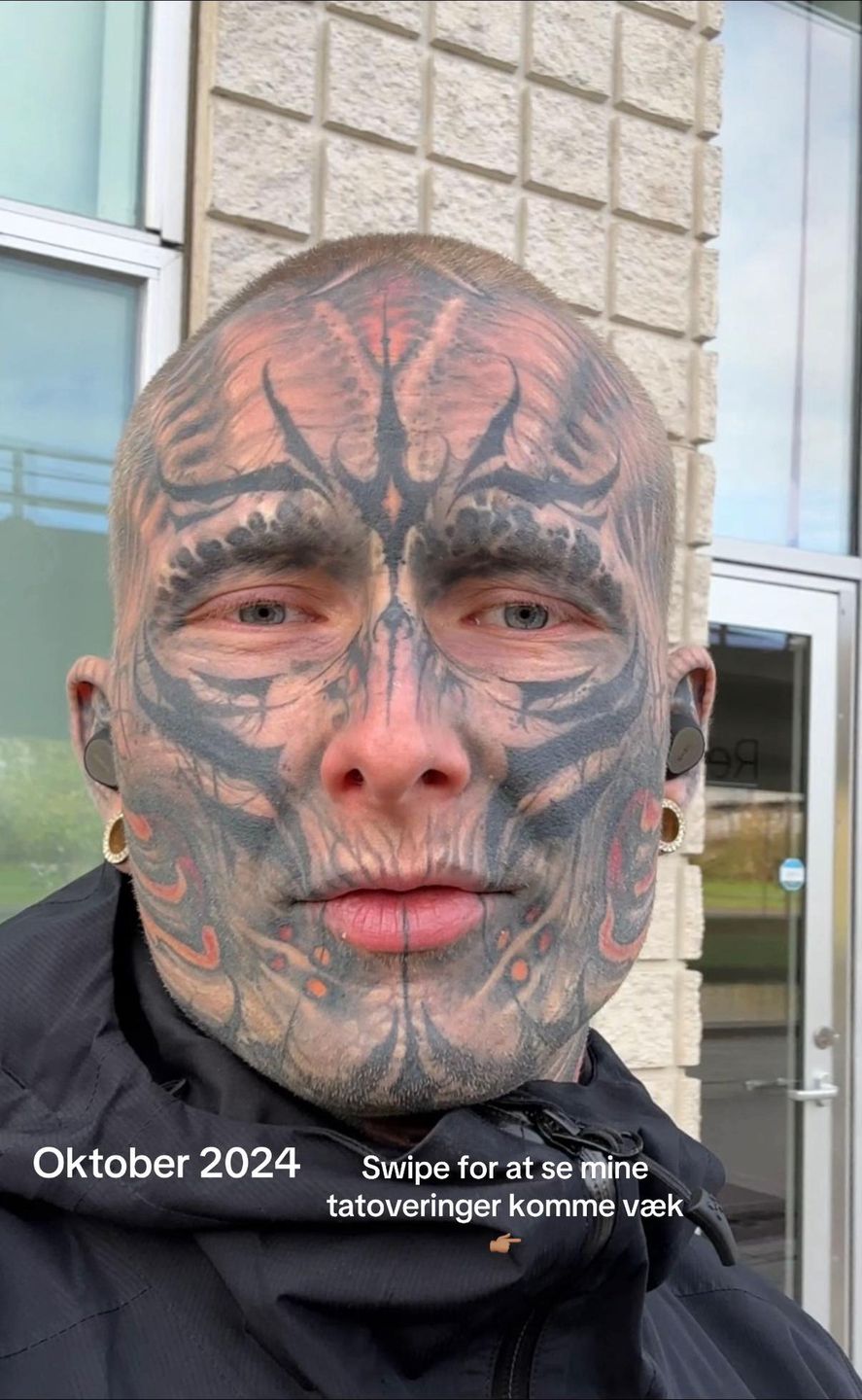 Tristan Weigelt przed usuwaniem tatuaży