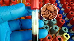 Ich cholesterol spadł. Zdecydowała popularna przekąska?