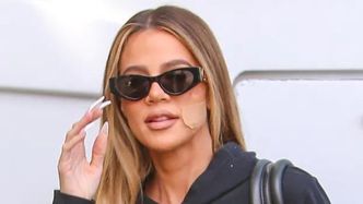 Khloe Kardashian tłumaczy, dlaczego nosi duży plaster na policzku: "Dochodzę już DO ZDROWIA"