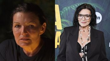 Ilona Felicjańska przeszła OPERACJĘ PLASTYCZNĄ: "Przyjemne z pożytecznym". Już zapomniała, co mówiła w "Królowej przetrwania"? (FOTO)