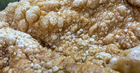 Cholesterol – jak go kontrolować i czego unikać, problemy z cholesterolem. Jak w łatwy sposób obniżyć cholesterol?