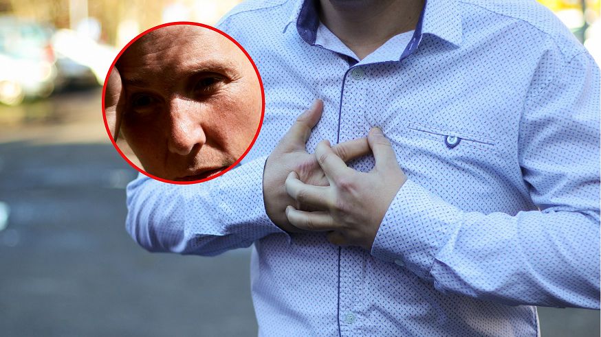 Zmiany widoczne na skórze mogą alarmować o problemach z sercem