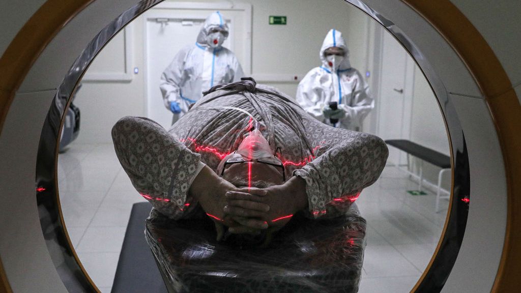 Jelita to nasz drugi mózg. Dieta może łagodzić mgłę mózgową po COVID