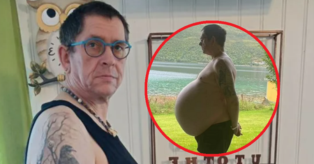 Niemiec miał mieć operację zmniejszenia żołądka. Wtedy lekarze coś odkryli