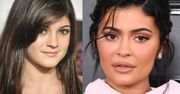 Kylie Jenner wypiera się operacji plastycznych: "Nigdy bym czegoś takiego nie zrobiła!"