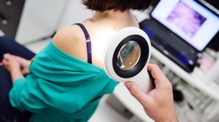 Warto pokonać strach przed dermatologiem. Badanie jest krótkie