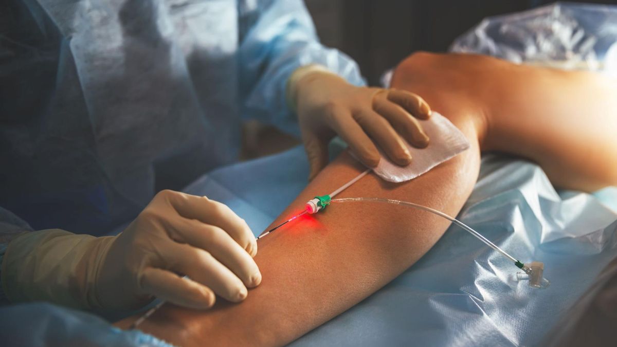 Coraz wiecej osób zmaga się z chorobami żył