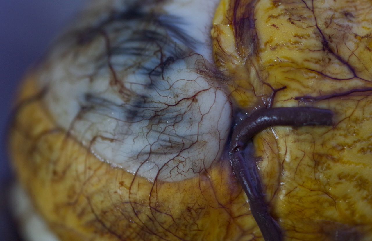 Na Filipinach się tym zajadają. Samo patrzenie na to u wielu wywołuje mdłości