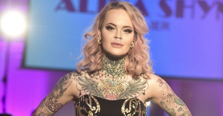 Monika Miller przeszczepiła włosy. Pokazała relację z zabiegu