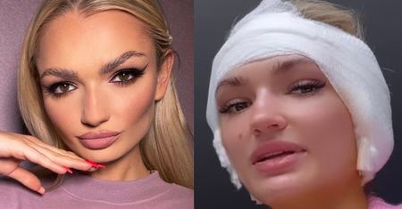 Aleksandra Daniel z "Love Island" relacjonuje operacje PIERSI I USZU. Ujawnia, ile zapłaciła...