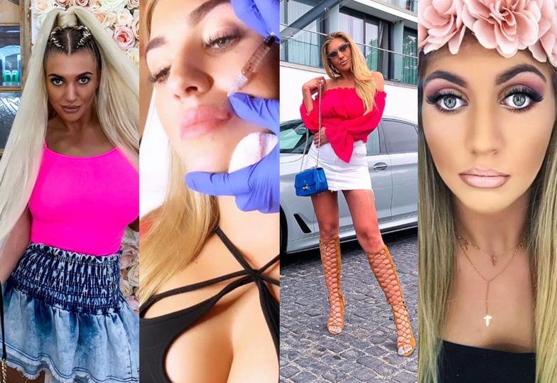 Pamiętacie przyjaciółkę Marty Linkiewicz z autokaru Rae Sremmurd? Zuzanna Alicja uwielbia medycynę estetyczną i nie boi się tego pokazywać