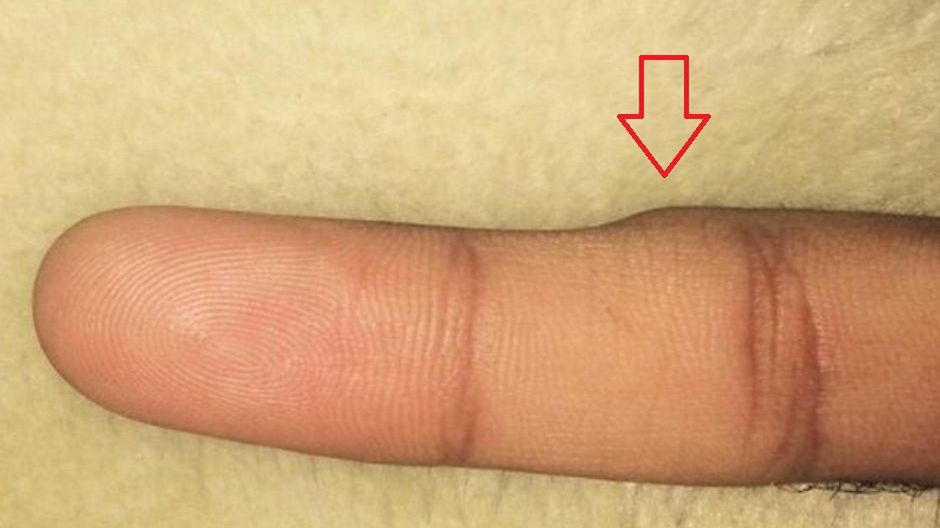 "Smartphone Pinky" to nowa choroba cywilizacyjna powodowana nadużywaniem smartfona