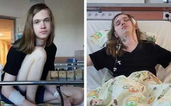 Igor walczy z agresywnym nowotworem. "Nigdy się nie poddał"