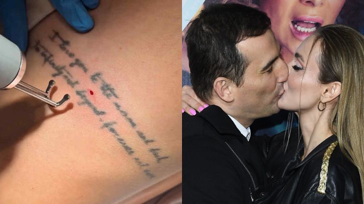 Marcela Leszczak usuwa tatuaż