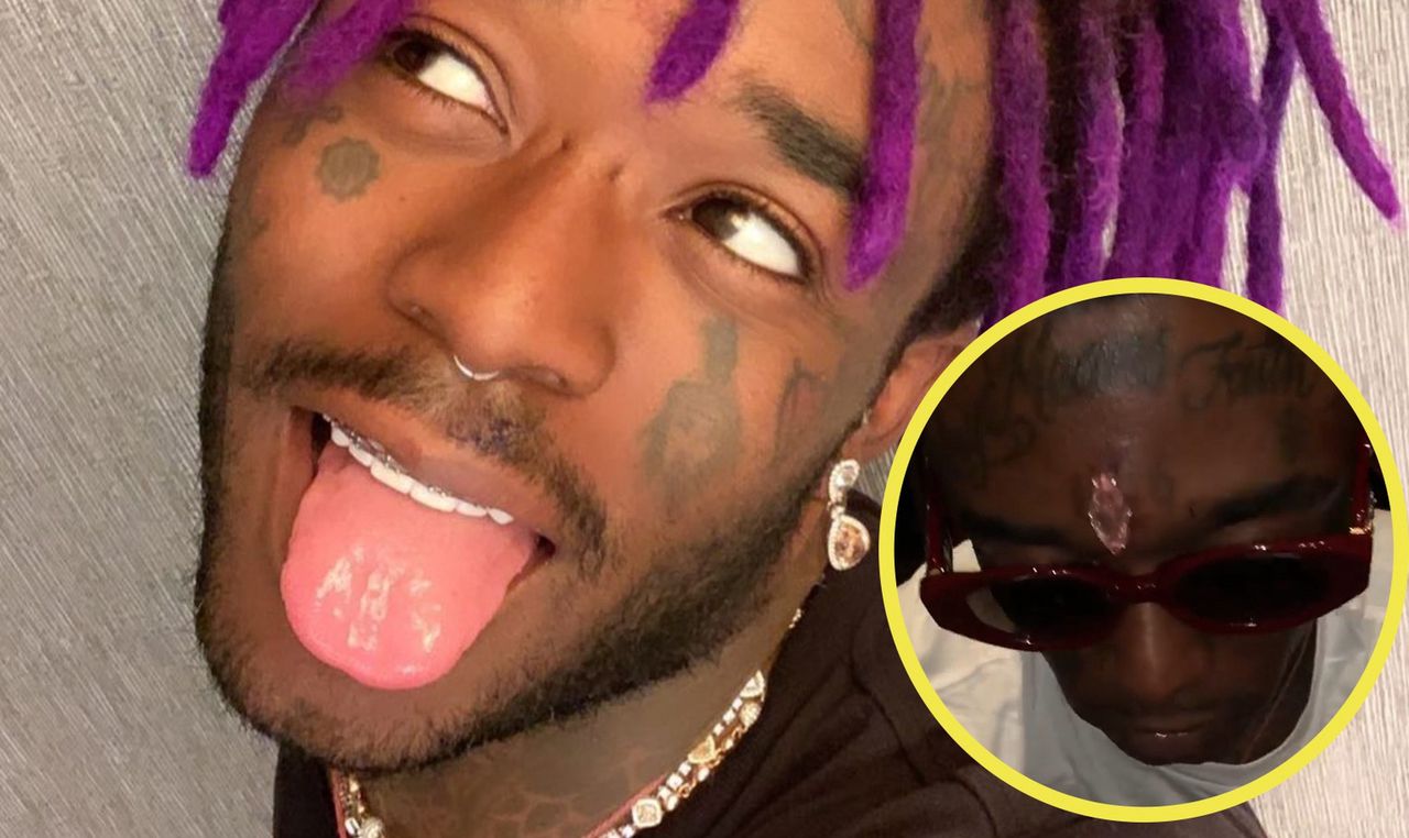 Lil Uzi Vert wszczepił sobie diament w czoło.