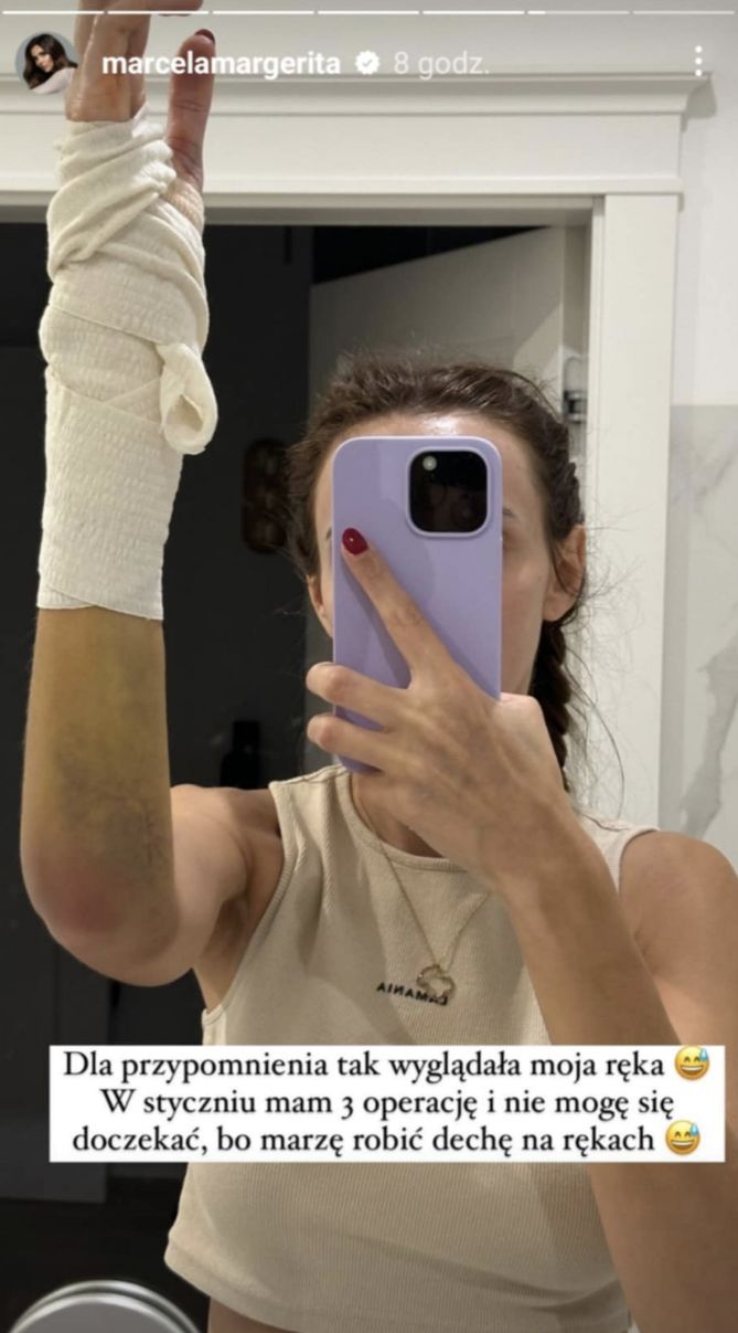 Marcela Leszczak złamała rękę w 4 miejscach