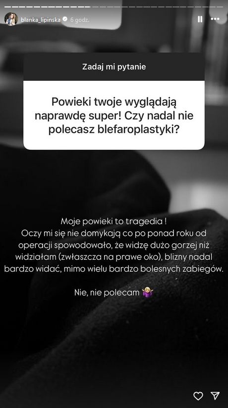 Blanka Lipińska o poprawkach w wyglądzie