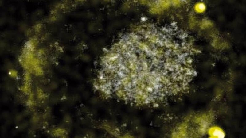 Bakteria wydalająca złoto