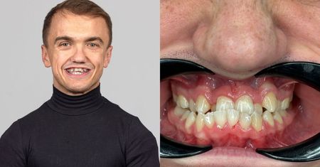 Mini Majk zaskoczył metamorfozą. Pokazał swój nowy uśmiech