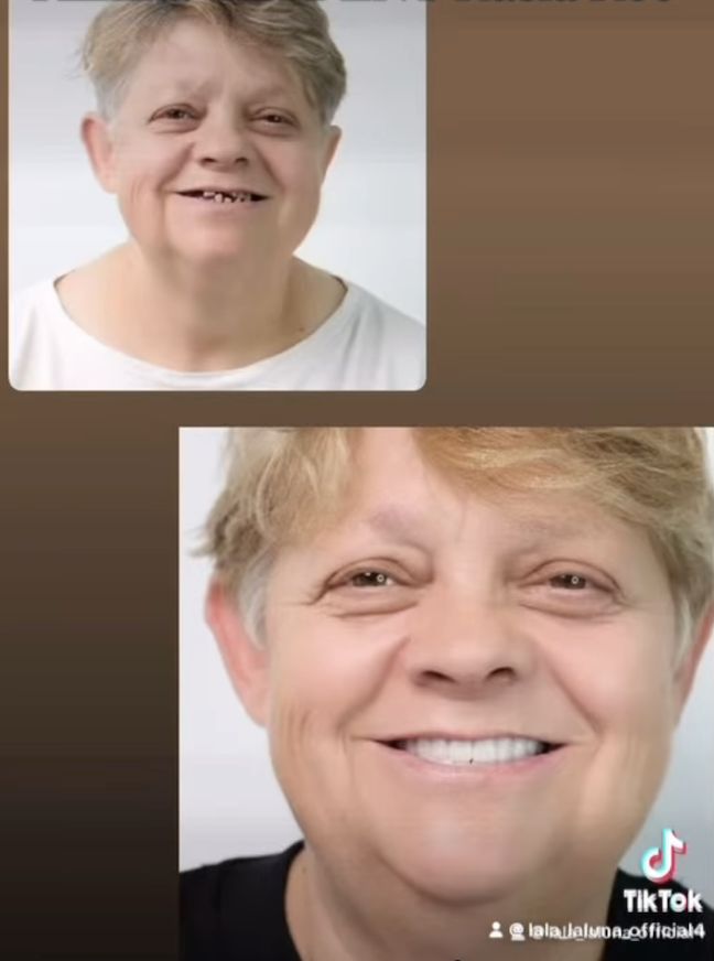 Mama Laluny pochwaliła się tureckim uzębieniem