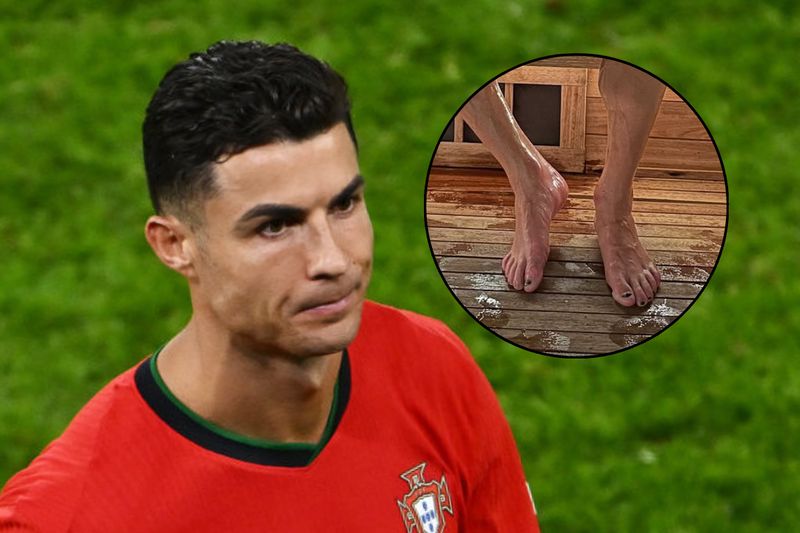 stopy-cristiano-ronaldo-wygl-daj-niepokoj-co-podolo-ki-si-im-przyjrza-y