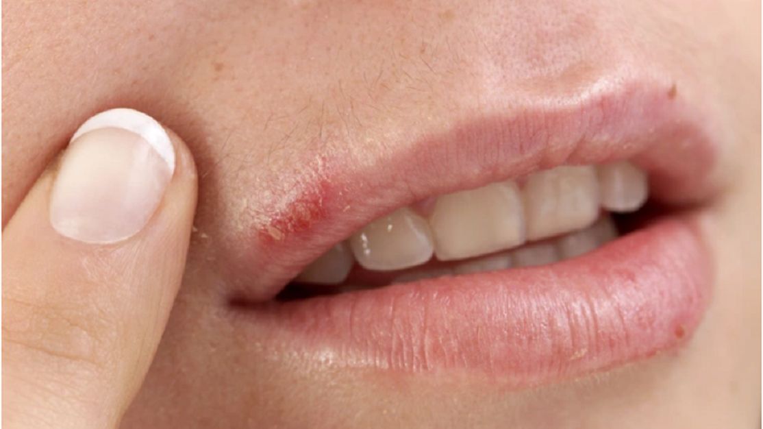 Groźny niedobór selenu