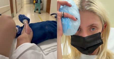 Taylor Momsen została ugryziona przez JADOWITEGO PAJĄKA! Gwiazda "Plotkary" wylądowała w szpitalu (FOTO)