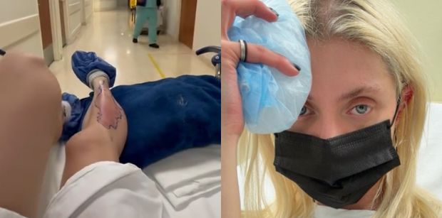 Taylor Momsen została ugryziona przez JADOWITEGO PAJĄKA! Gwiazda "Plotkary" wylądowała w szpitalu (FOTO)