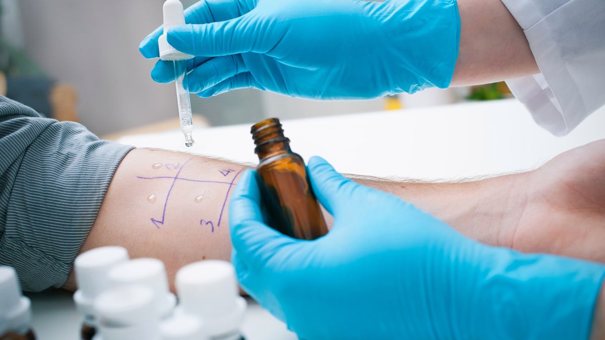 Testy alergiczne płatkowe – wskazania, przeciwwskazania, opis, wady