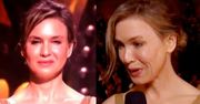 Co się stało z twarzą Renee Zellweger?!