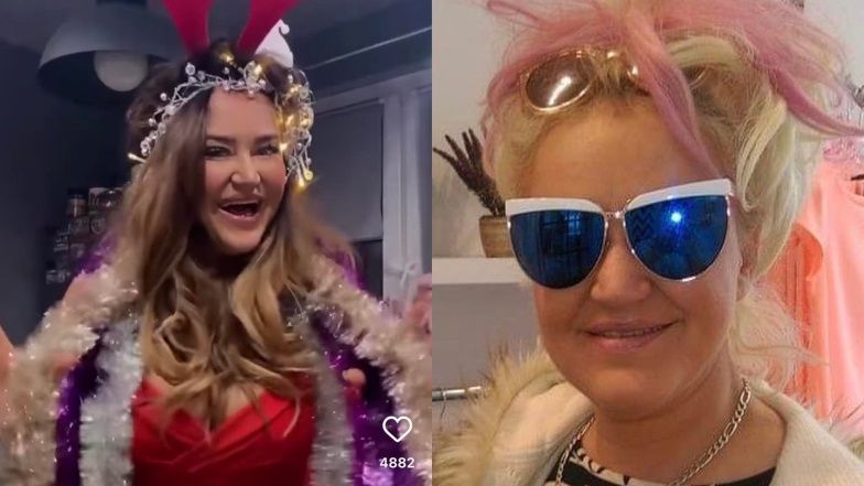 Agnieszka Kotońska podejrzewana o operacje plastyczne