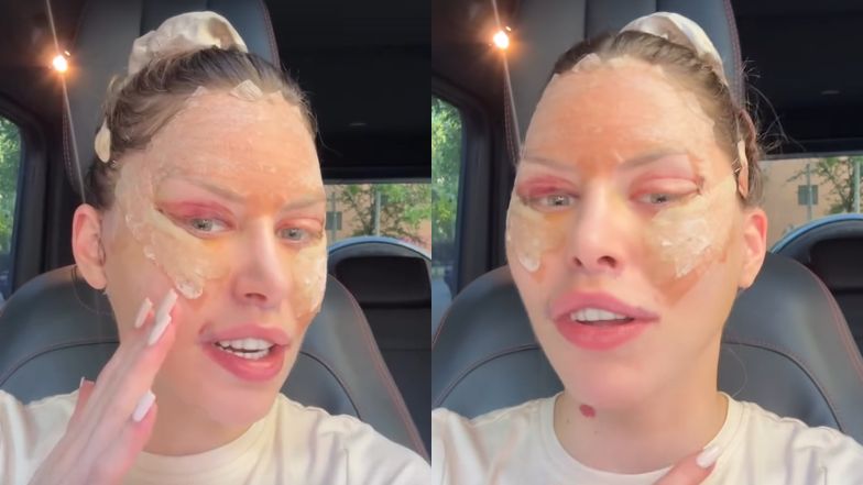 Julia von Stein wymienia, co sobie poprawiła liftingiem twarzy