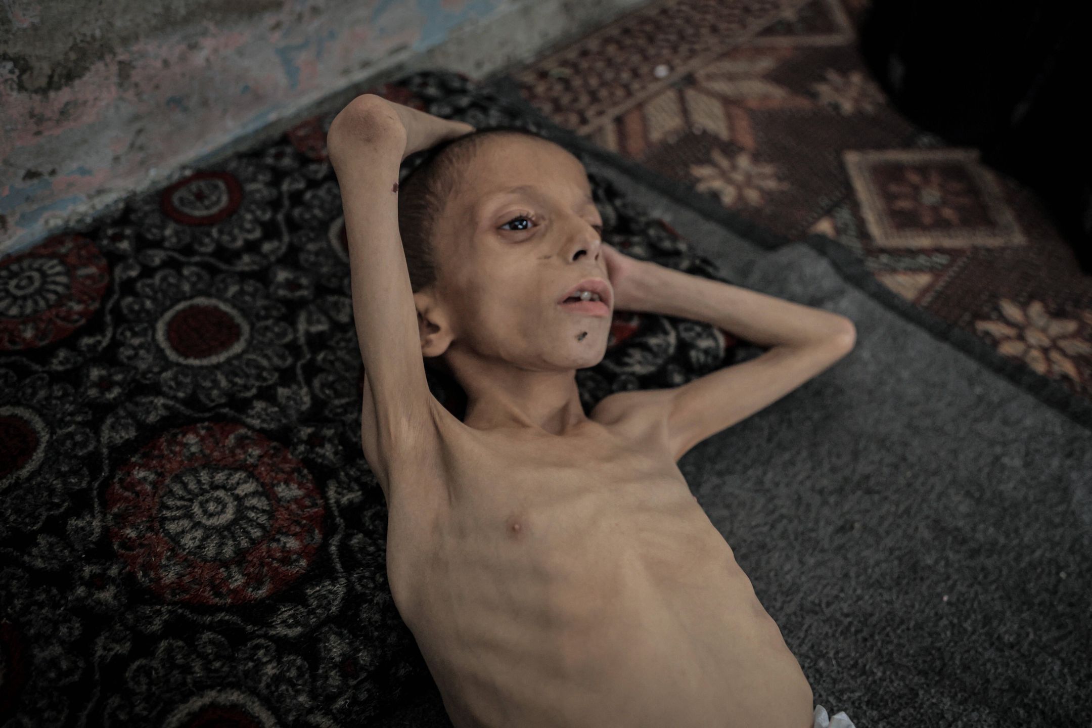 Strefa Gazy umiera z głodu