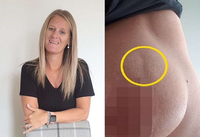 Demelza myślała, że to rozstęp