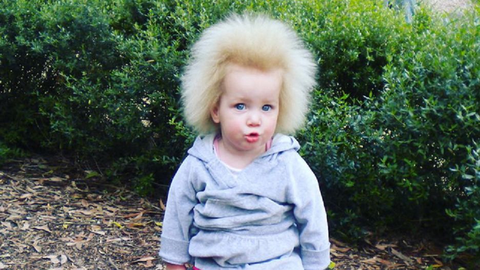 Pamiętacie dziewczynkę z włosami Einsteina? Dziś ma 12 lat