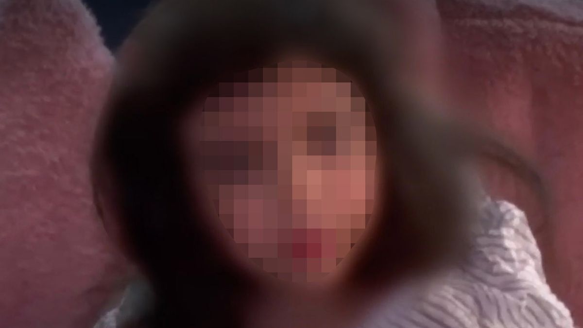 Dziewczynka nie odczuła jeszcze braku piersi