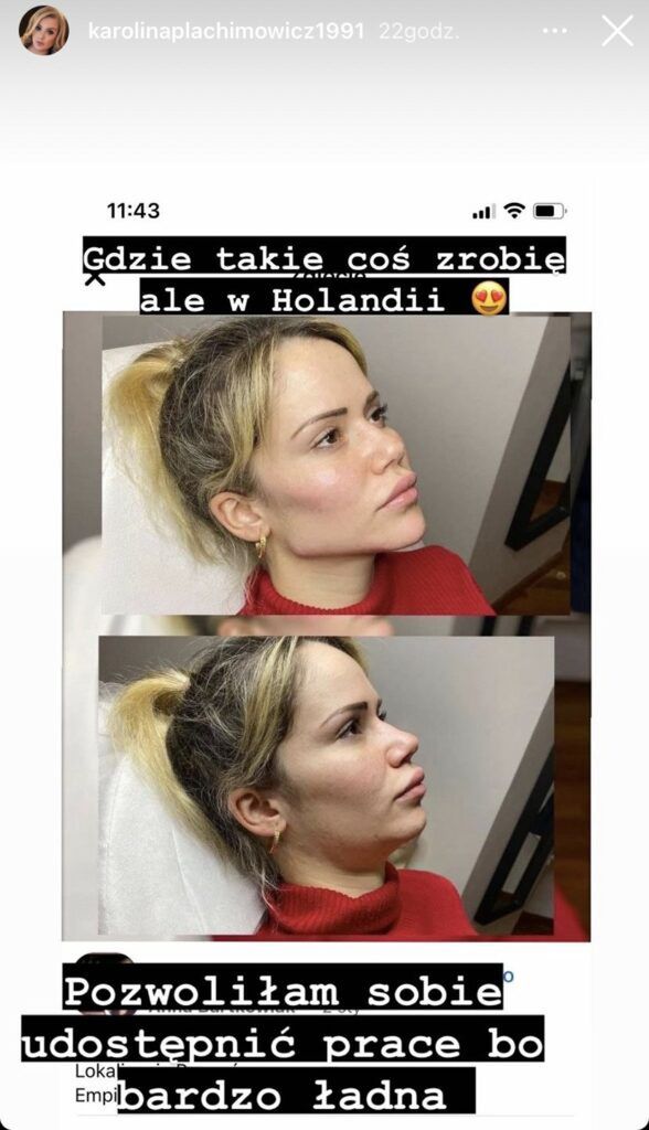Karolina Plachimowicz planuje operację plastyczną? 