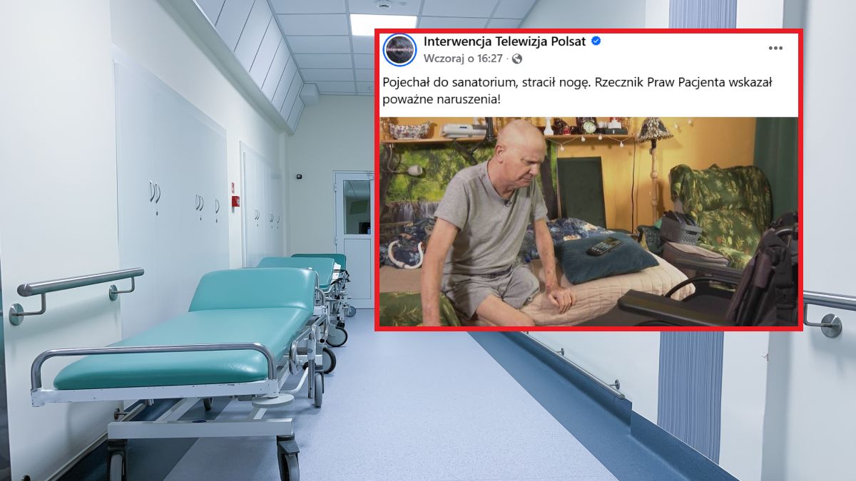 Mężczyzna stracił nogę