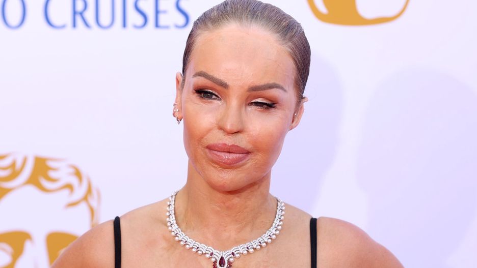 Katie Piper wyglądała pięknie na gali BAFTA 2024