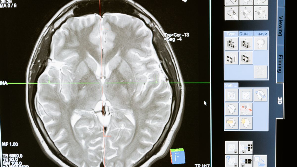 Tajemnicza choroba neurologiczna w Kanadzie 