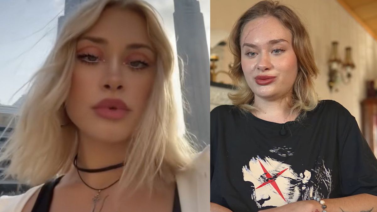 Modelka została brutalnie pobita w Dubaju. Ujawniła drastyczne szczegóły napaści